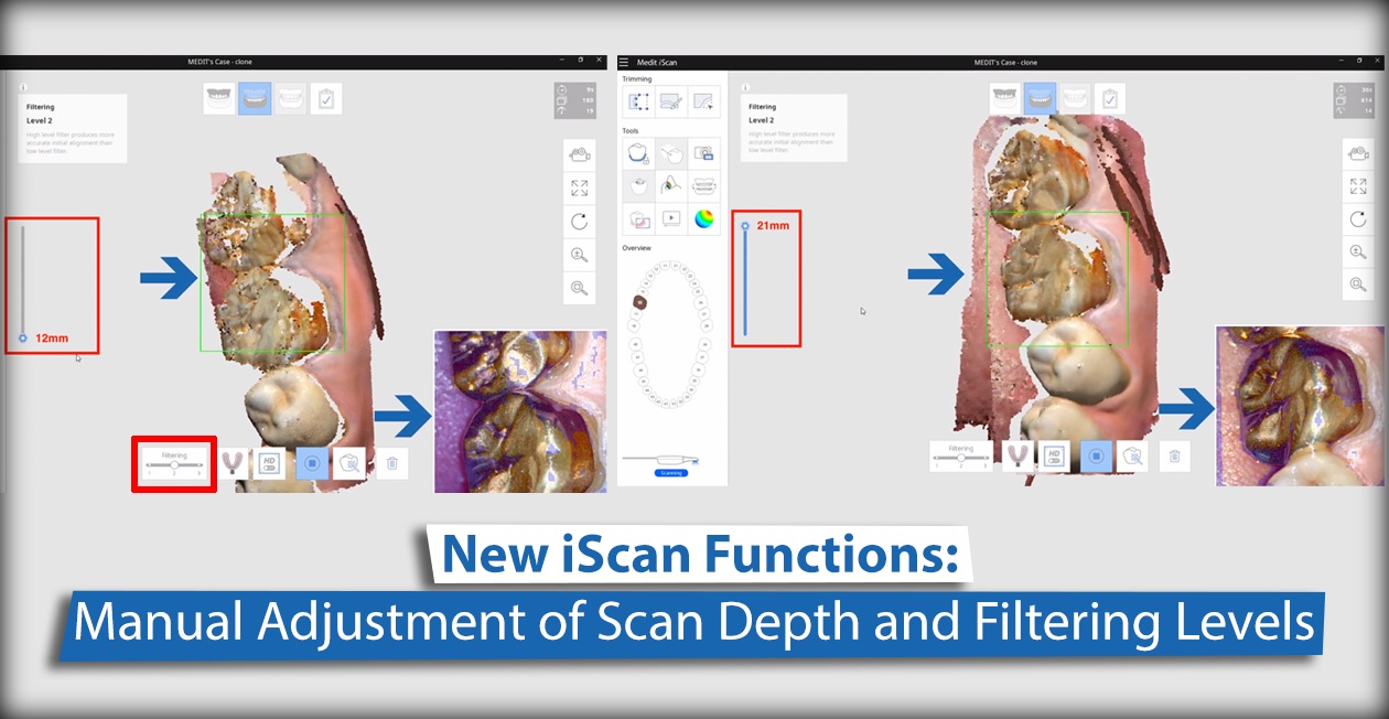 New iScan Functions: Manual Adjustment of Scan Depth and Filtering Levels